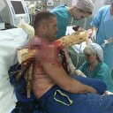 Vücuduna dev kütük saplandı