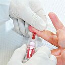 اختبار دم يتنبأ بخطر إصابة المواليد بالشلل الدماغي التشنجي