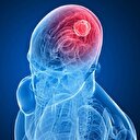 Ani davranış değişikliği beyin tümörü belirtisi olabilir