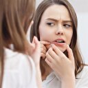 Fazla yağ tüketimi sivilce yapıyor