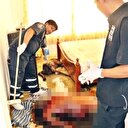 Aç kalan köpek ölen sahibinin suratını yedi