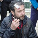 Fotoğraf çektiremeyen hayran Nejat İşler'in dişini kırdı