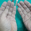 Cerrahın elleri sosyal medyayı salladı
