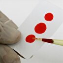 Uzmanlar uyardı: Kayıp hepatitli kalmasın