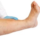 Uzmanlar uyarıyor: Ayağınızı, bacağınızı kaybedebilirsiniz