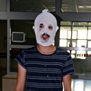 Merdiven altı krem yüzünü yaktı