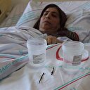 66 yıl boyunca vücudundaki iğnelerle yaşadı
