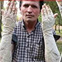 23 yıldır hastalıkla mücadele eden adam kurtuldu