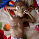 Yemen'in savaş mağduru çocukları