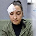 Dikiş atılan iğne kafasında unutuldu