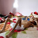 BM'den korkutan uyarı: 13,4 milyon Yemenli ölüm riskiyle karşı karşıya