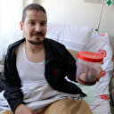 Mesanesinden 840 gram taş çıktı