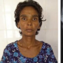 Karnı ağrıyan kadının midesinden çıkanlar şaşkına çevirdi