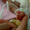 Dünyada her yıl 15 milyon bebek prematüre doğuyor