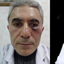 İki doktorun 'ameliyat gereksizdi' kavgası