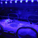 İyi sağlık hizmeti milyonlarca prematüre bebeği yaşatabilir