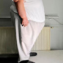 30 Obezite Merkezi açılacak