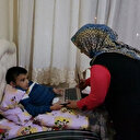 Acil karaciğer nakli bekliyor