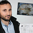 Ekmeğin içinden çıkan vida boğazını yırttı