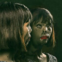 Babası tarafından asit saldırısına uğradı nedeni ise tüyler ürpertiyor