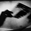 Verem 2017'de 1,3 milyon can aldı