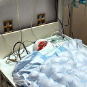 Yangında yüzünü elyaf yastıkla kapatınca vücudunun yarısı yandı