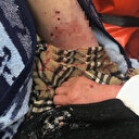 Kırşehir'de köpeklerin saldırdığı kadın yaralandı