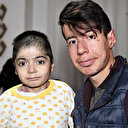 Kelebek hastası kardeşlere umut oldular