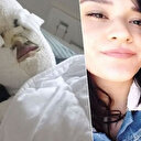 Asitle yüzü yakılan kızdan kötü haber: Gözünü kaybedebilir