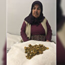 Safra kesesinden 311 tane taş çıktı