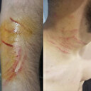 Amedspor-Sakaryaspor maçında olay: Sahaya kesici aletle çıktı