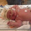 ABD'de bir kız bebek 7 kilo doğdu