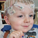 Adı konmamış hastalık: İsimsiz sendrom