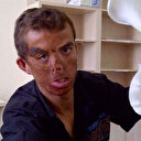 Türkiye'de ilk yüz nakli olmuştu: Yüzüme sinek konunca mutlu oluyorum