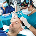 Saç ekim ekonomisi 1 milyar doları geçti