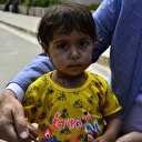 Kalbi delik ve damarları ters olan Aye Türkiye’de sağlığına kavuştu