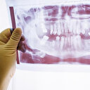 Türkiye’nin yüzde 70’inde çene eklem rahatsızlığı var