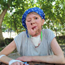 Çenesinde çıkan sivilce hayatını kararttı: Kızının derdine düştü