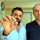 Tükürük bezinden 3 santimetre çapında taş çıktı: Dünyadaki ilk 10 taş arasına giriyor