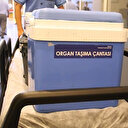 Türkiye'den dünyaya organ nakli eğitimi: 78 ülkeden bin 669 kişiye eğitim verildi