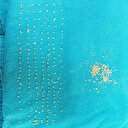 Tamı tamına 200 tane: 94 yaşındaki hastanın safra kesesinden çıkarıldı