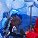 Uyanıkken beyin ameliyatı oldu: Kendisiyle beraber binlerce kişi izledi