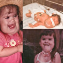 Şimdiki haline gelebilmek için 55 ameliyat geçirdi