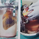 Ölen kişinin kalbini 'diriltip' başka bir hastaya naklettiler