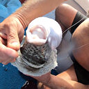 Çığır açacak buluş: Siyanürden güçlü balon balığı eklem ağrılarına iyi gelecek