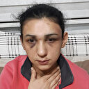 Eski eşinden şiddet gören kadının yardım çığlığı: 'Eski eşi tarafından defalarca darp edildi, ardından öldürüldü' haberlerinin bir parçası olacağız