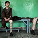 Afganistan'da çocuk olmak: Protez bacağa mahkumsun