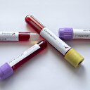 Çin İran'a koronavirüs tespiti için 20 bin kit daha gönderdi