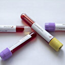 Koronavirüs testleri yarından itibaren Kayseri Şehir Hastanesi’nde yapılmaya başlanacak