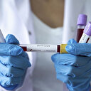 Papua Yeni Gine’de ilk koronavirüs vakası görüldü